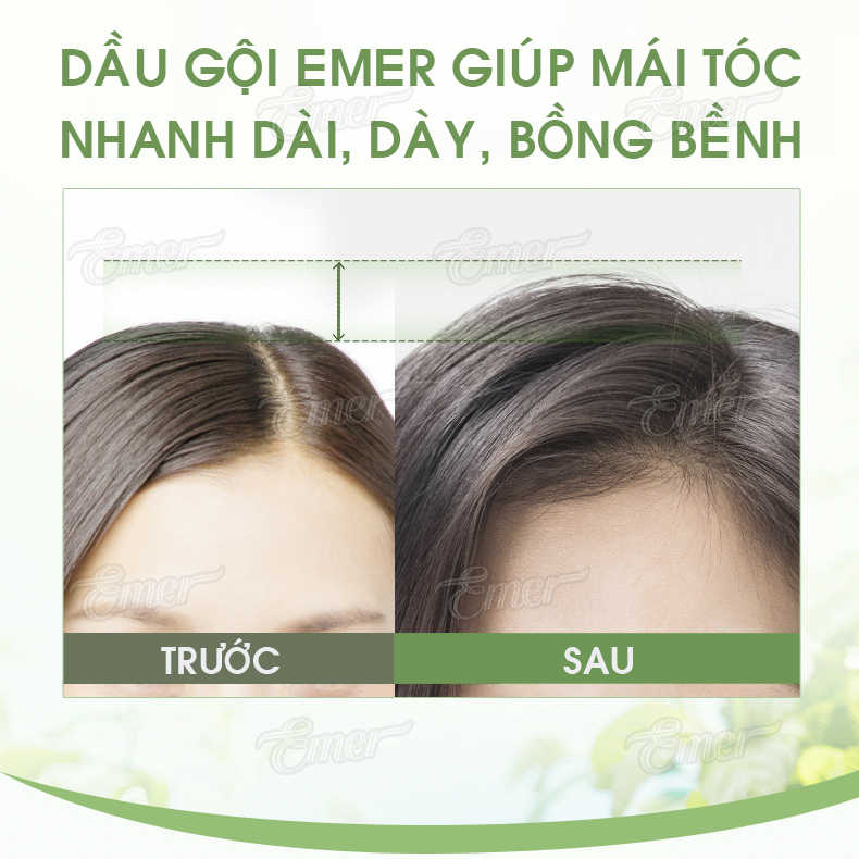 Dầu gội bưởi Emer