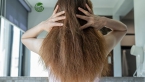 Rụng tóc nhiều ở trẻ 10 tuổi: Nguyên nhân và cách điều trị hiệu quả